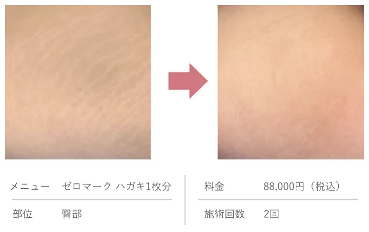 ビフォーアフター比較画像