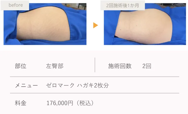 施術効果の写真