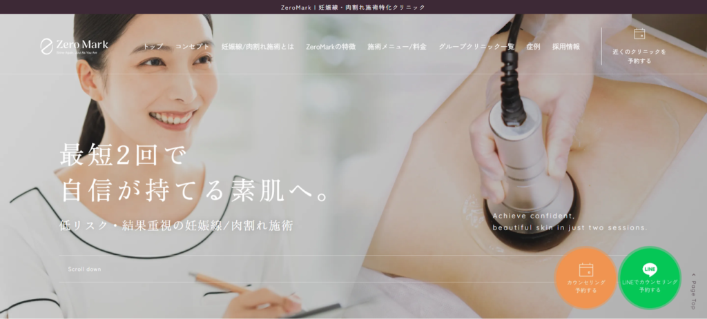 妊娠線を予防しても症状が出てしまった場合は「ZeroMark」へご相談ください