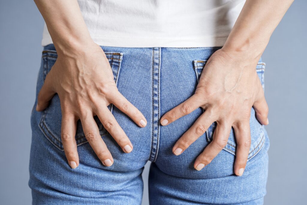 お尻まわりに肉割れができる5つの原因