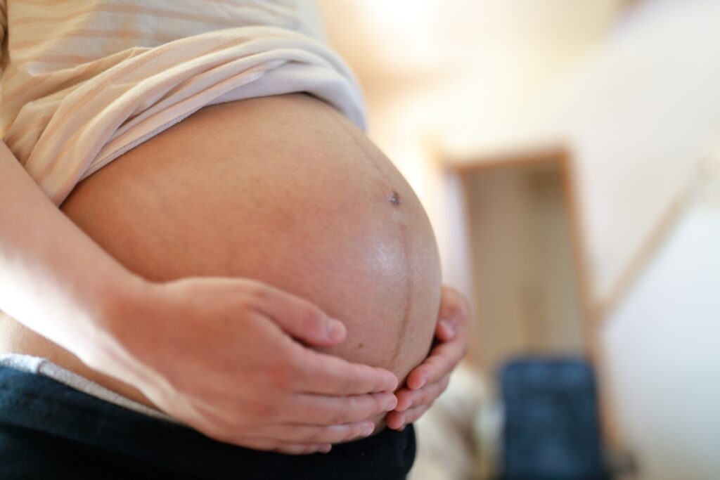妊娠線を放置するリスク3選